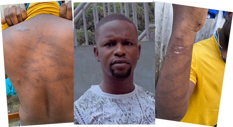Torturé et emprisonné : le silence assourdissant de la société civile et des autorités gabonaises  